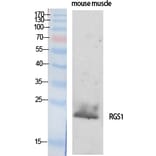 Western Blot - Anti-RGS1 Antibody (C18308) - Antibodies.com