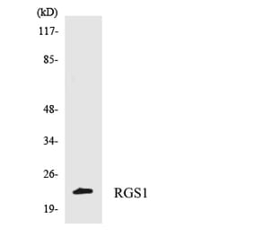 Western Blot - Anti-RGS1 Antibody (R12-3432) - Antibodies.com