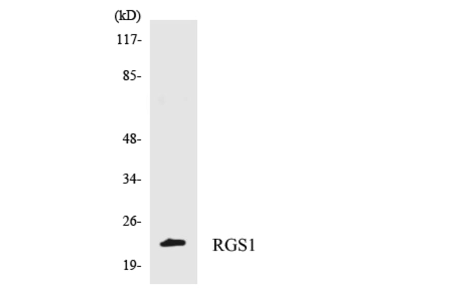 Western Blot - Anti-RGS1 Antibody (R12-3432) - Antibodies.com