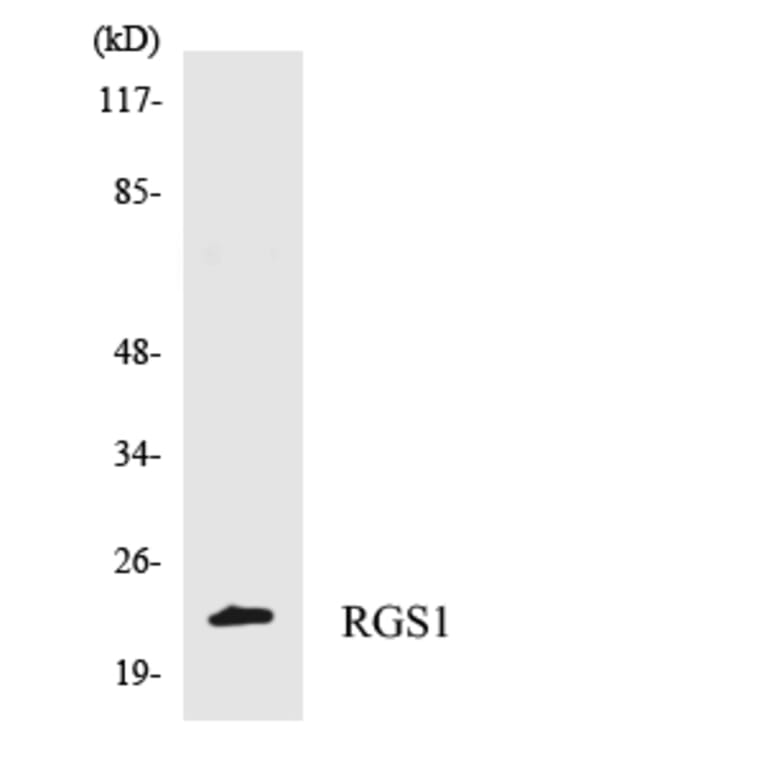 Western Blot - Anti-RGS1 Antibody (R12-3432) - Antibodies.com