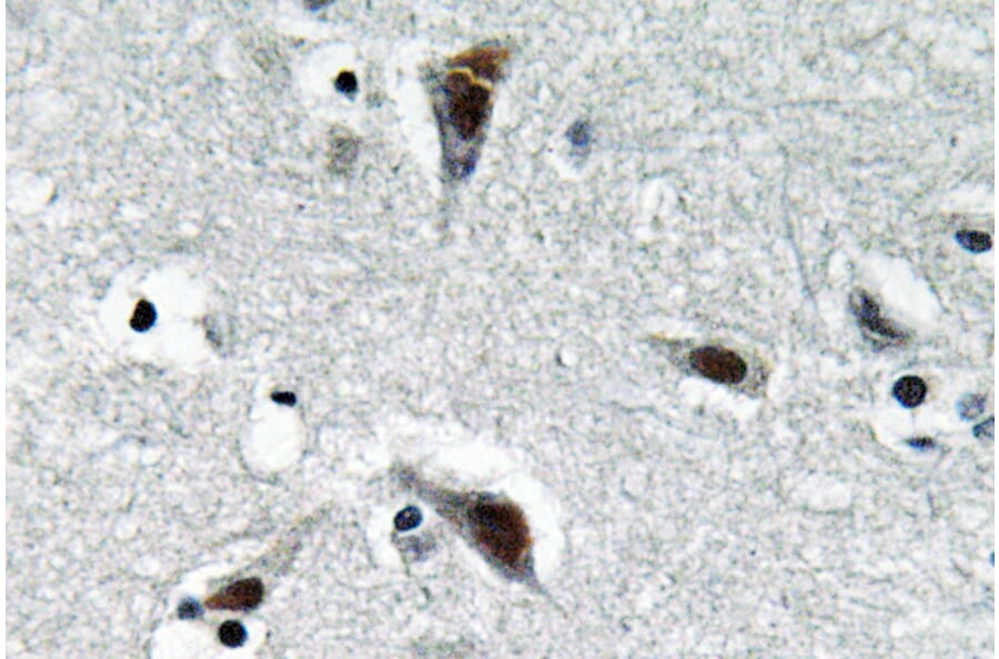 Immunohistochemistry - Anti-RFC3 Antibody (R12-2332) - Antibodies.com