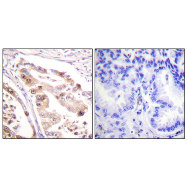Immunohistochemistry - Anti-RFA2 Antibody (B0985) - Antibodies.com