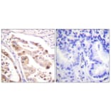 Immunohistochemistry - Anti-RFA2 Antibody (B0985) - Antibodies.com