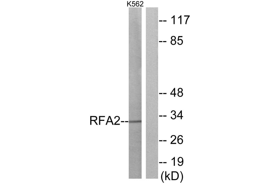 Western Blot - Anti-RFA2 Antibody (B0985) - Antibodies.com