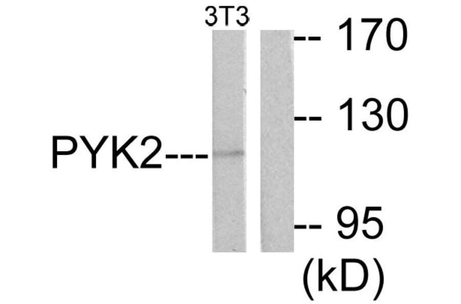 Western Blot - Anti-PYK2 Antibody (B0083) - Antibodies.com
