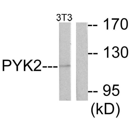 Western Blot - Anti-PYK2 Antibody (B0083) - Antibodies.com