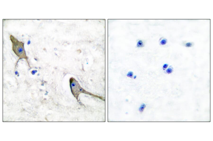 Immunohistochemistry - Anti-PYK2 Antibody (B0083) - Antibodies.com