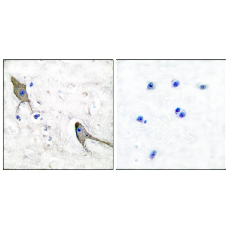 Immunohistochemistry - Anti-PYK2 Antibody (B0083) - Antibodies.com