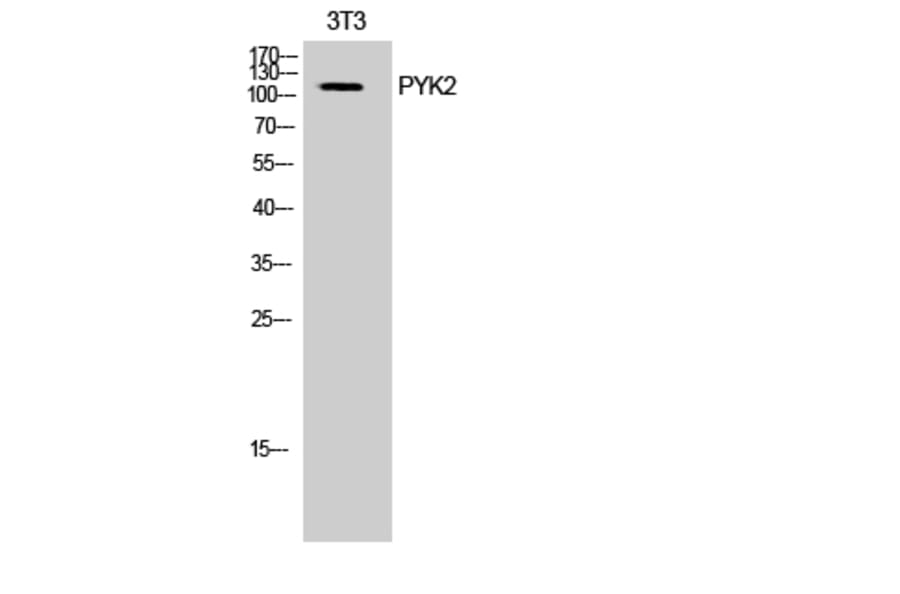 Western Blot - Anti-PYK2 Antibody (B0083) - Antibodies.com