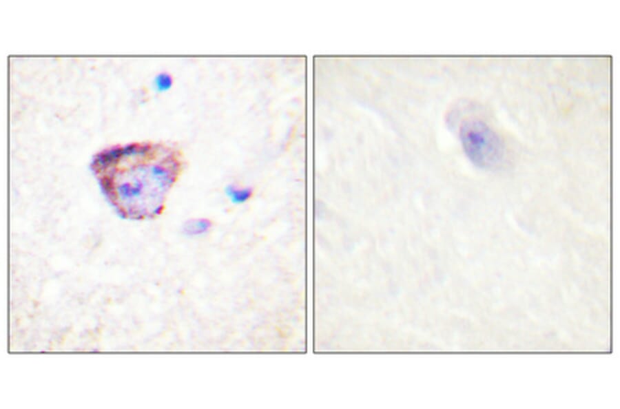 Immunohistochemistry - Anti-PYK2 Antibody (B0083) - Antibodies.com