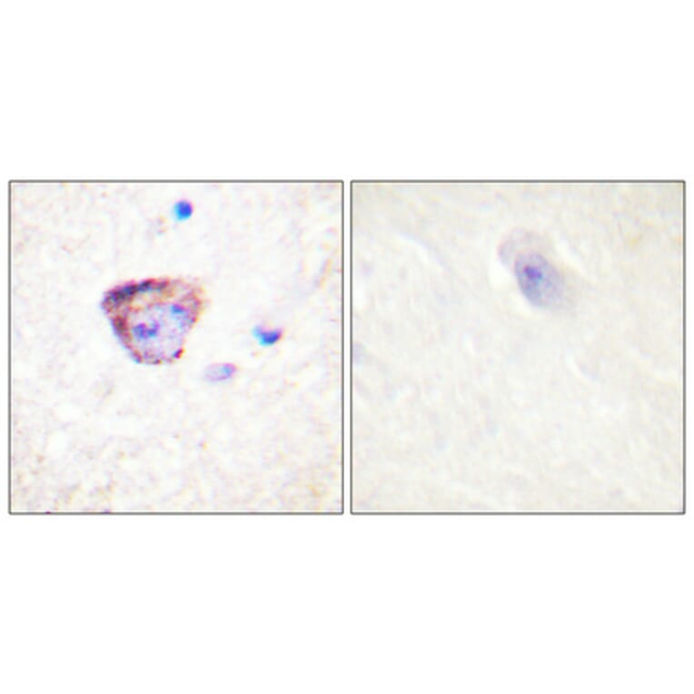 Immunohistochemistry - Anti-PYK2 Antibody (B0083) - Antibodies.com