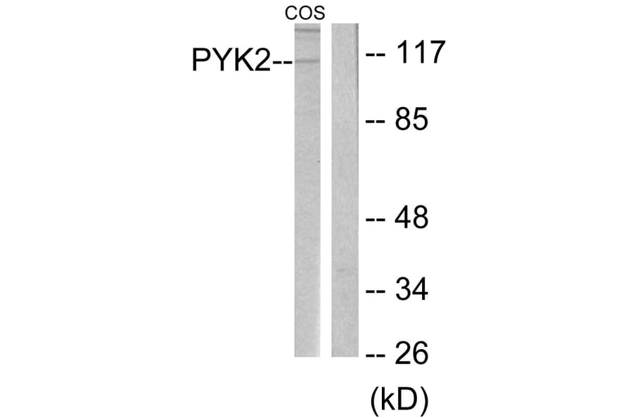 Western Blot - Anti-PYK2 Antibody (B0084) - Antibodies.com