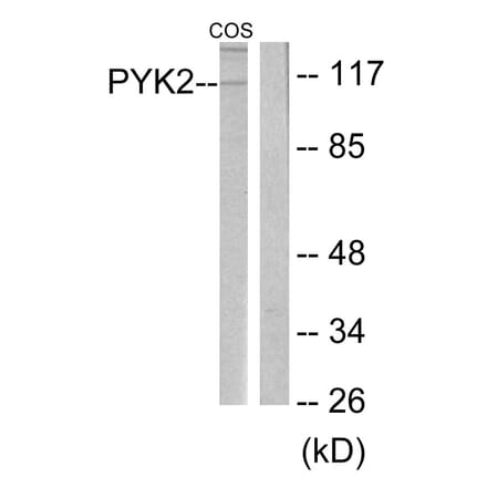 Western Blot - Anti-PYK2 Antibody (B0084) - Antibodies.com