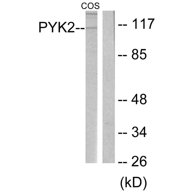 Western Blot - Anti-PYK2 Antibody (B0084) - Antibodies.com