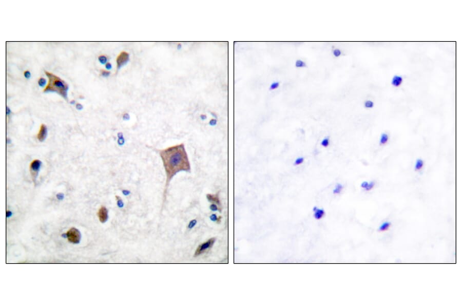 Immunohistochemistry - Anti-PYK2 Antibody (B0084) - Antibodies.com