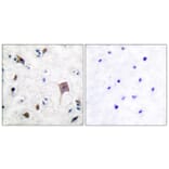 Immunohistochemistry - Anti-PYK2 Antibody (B0084) - Antibodies.com