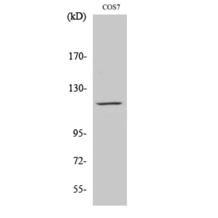 Western Blot - Anti-PYK2 Antibody (B0084) - Antibodies.com