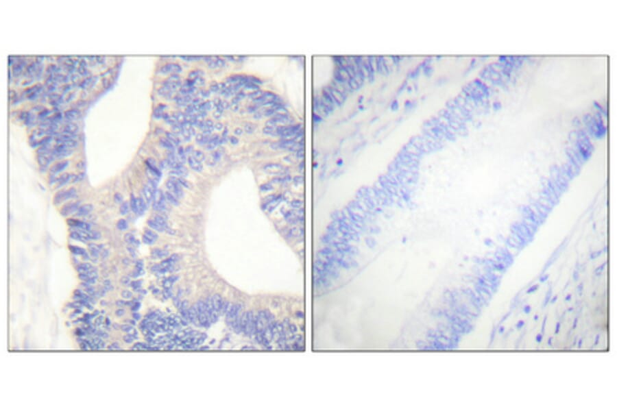Immunohistochemistry - Anti-PYK2 Antibody (B0084) - Antibodies.com