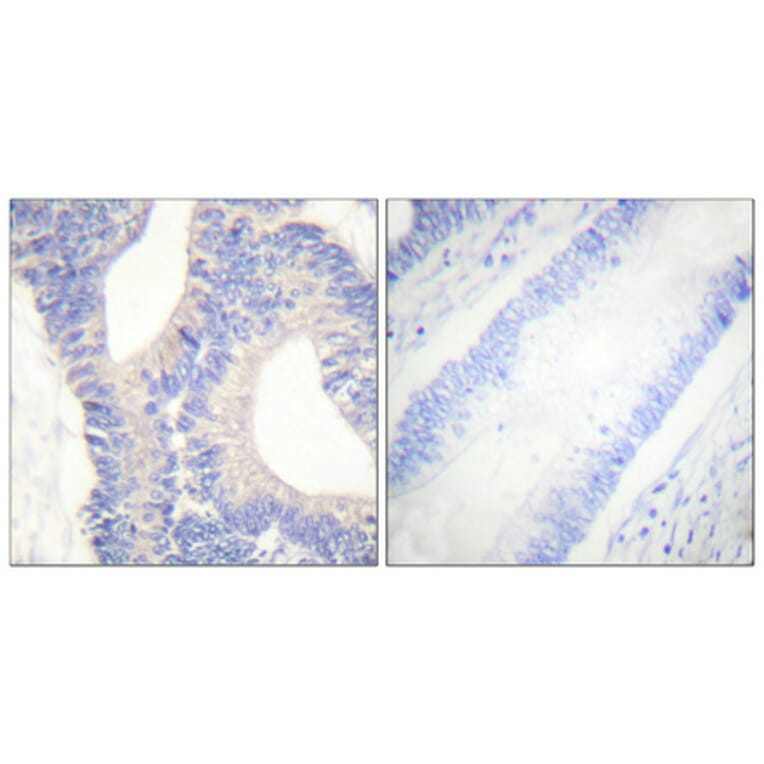 Immunohistochemistry - Anti-PYK2 Antibody (B0084) - Antibodies.com