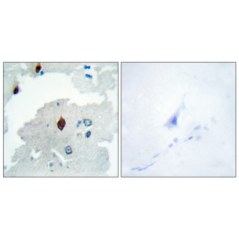 Immunohistochemistry - Anti-PTTG Antibody (C10723) - Antibodies.com