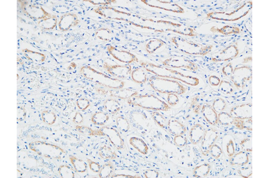Immunohistochemistry - Anti-PTTG Antibody (C10723) - Antibodies.com