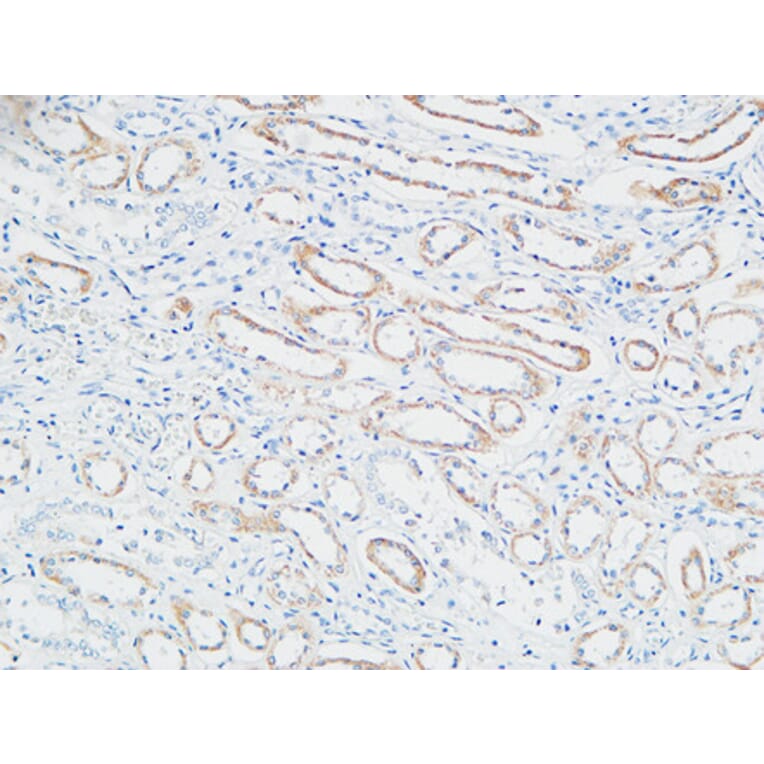 Immunohistochemistry - Anti-PTTG Antibody (C10723) - Antibodies.com