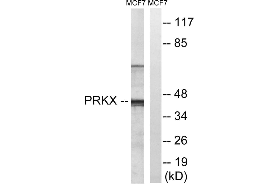 Western Blot - Anti-PRKX Antibody (C18601) - Antibodies.com