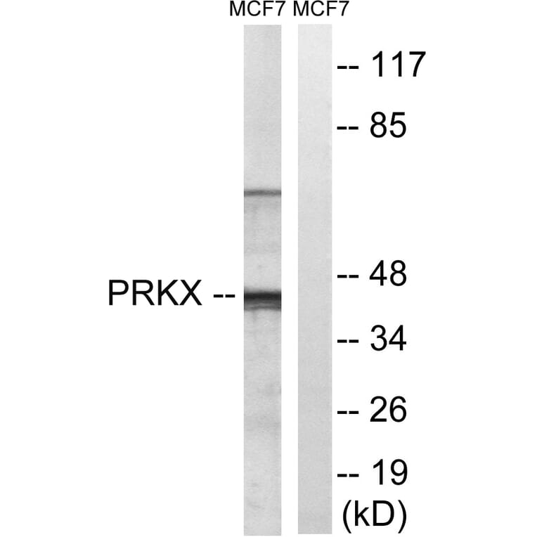 Western Blot - Anti-PRKX Antibody (C18601) - Antibodies.com