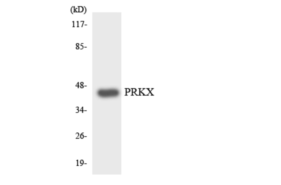 Western Blot - Anti-PRKX Antibody (R12-3367) - Antibodies.com