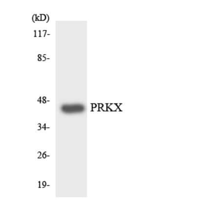 Western Blot - Anti-PRKX Antibody (R12-3367) - Antibodies.com