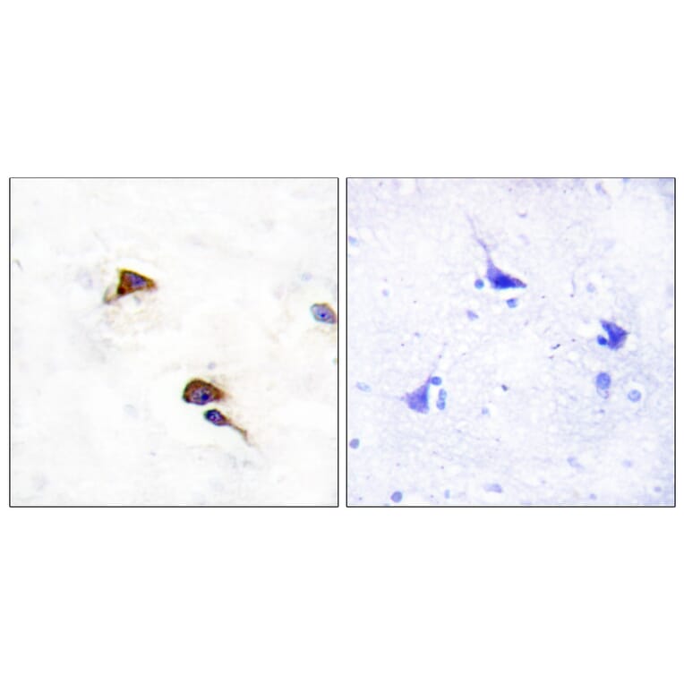 Immunohistochemistry - Anti-PPIF Antibody (C10516) - Antibodies.com
