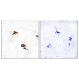 Immunohistochemistry - Anti-PPIF Antibody (C10516) - Antibodies.com