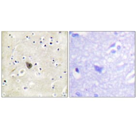 Immunohistochemistry - Anti-PKD2 Antibody (B0808) - Antibodies.com