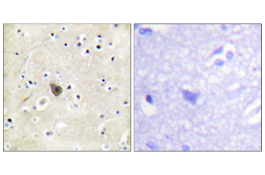 Immunohistochemistry - Anti-PKD2 Antibody (B0808) - Antibodies.com