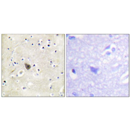 Immunohistochemistry - Anti-PKD2 Antibody (B0808) - Antibodies.com