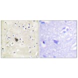 Immunohistochemistry - Anti-PKD2 Antibody (B0808) - Antibodies.com