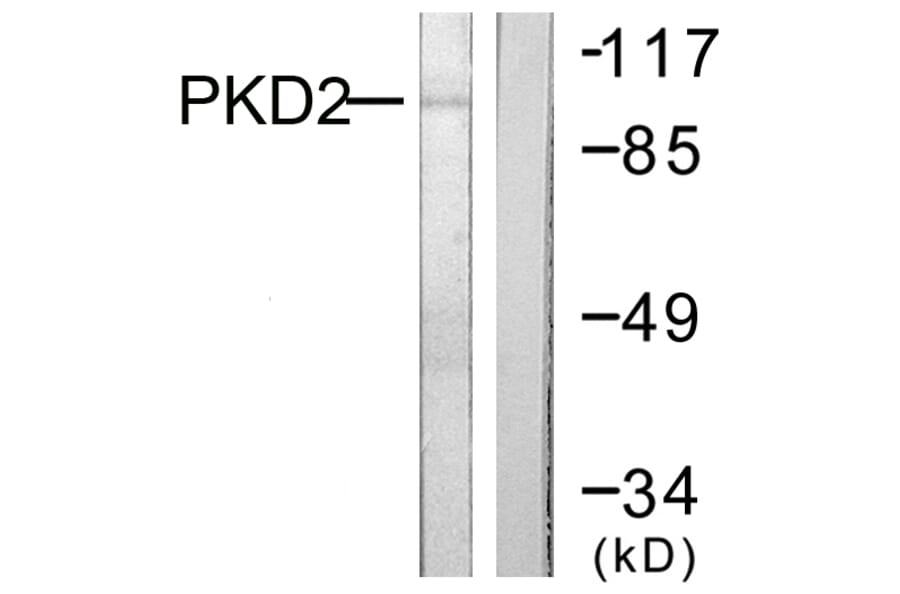 Western Blot - Anti-PKD2 Antibody (B0808) - Antibodies.com