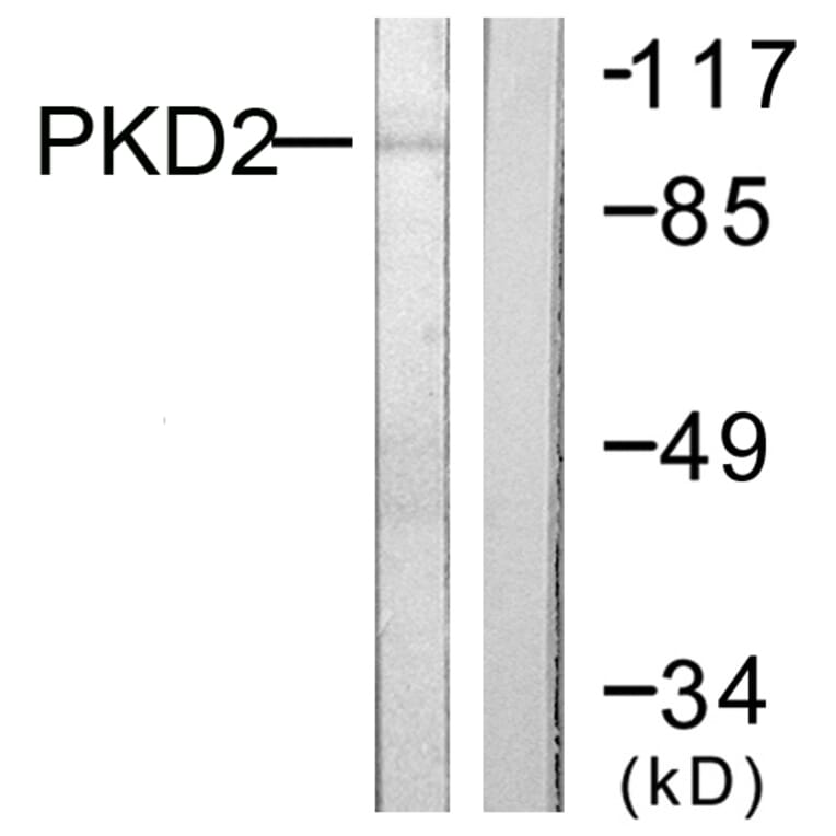 Western Blot - Anti-PKD2 Antibody (B0808) - Antibodies.com