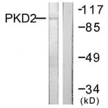 Western Blot - Anti-PKD2 Antibody (B0808) - Antibodies.com