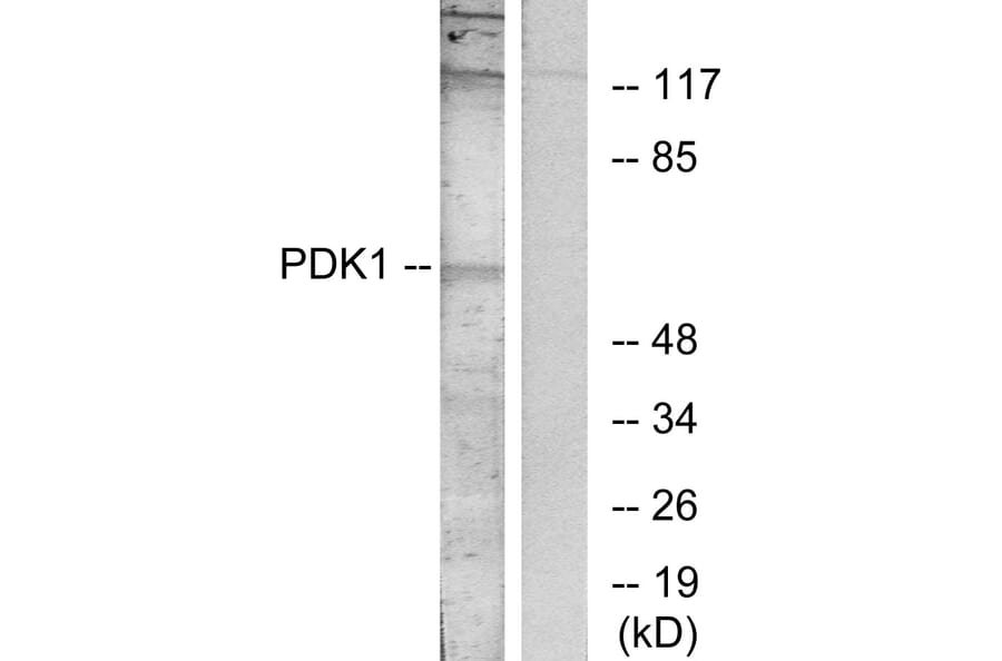 Western Blot - Anti-PDK1 Antibody (B7195) - Antibodies.com