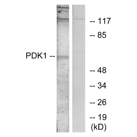 Western Blot - Anti-PDK1 Antibody (B7195) - Antibodies.com