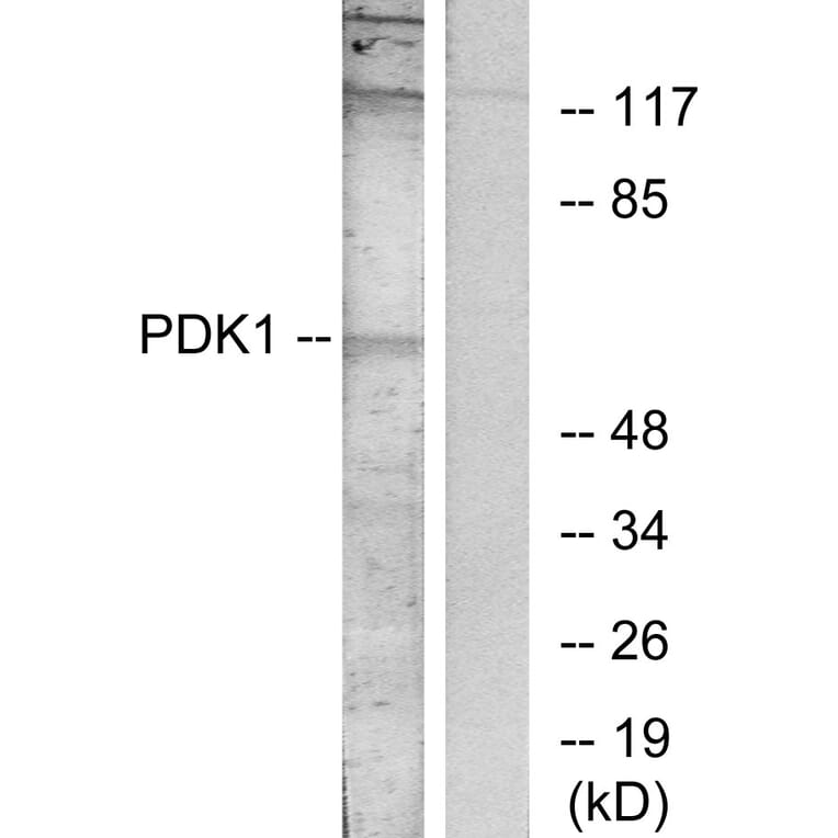 Western Blot - Anti-PDK1 Antibody (B7195) - Antibodies.com