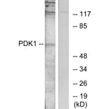 Western Blot - Anti-PDK1 Antibody (B7195) - Antibodies.com