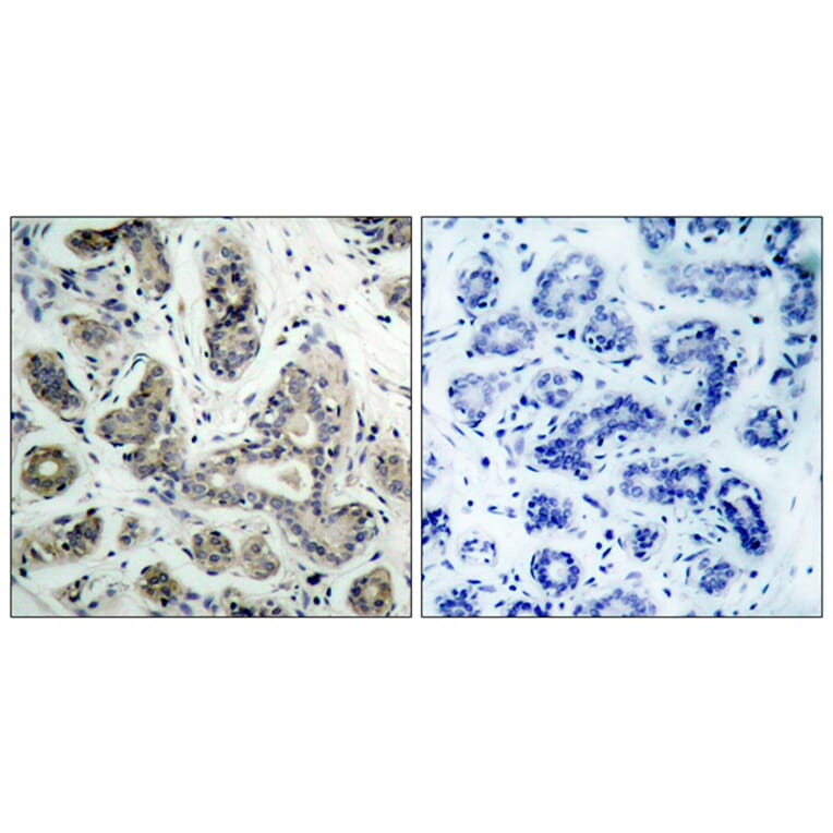 Immunohistochemistry - Anti-PDK1 Antibody (B7195) - Antibodies.com