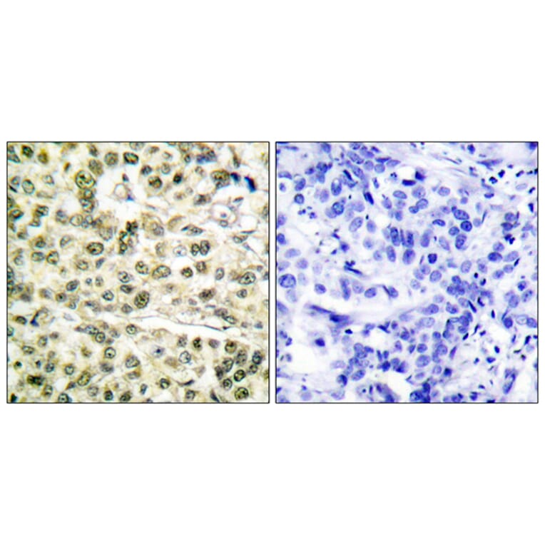 Immunohistochemistry - Anti-PCNA Antibody (C0298) - Antibodies.com