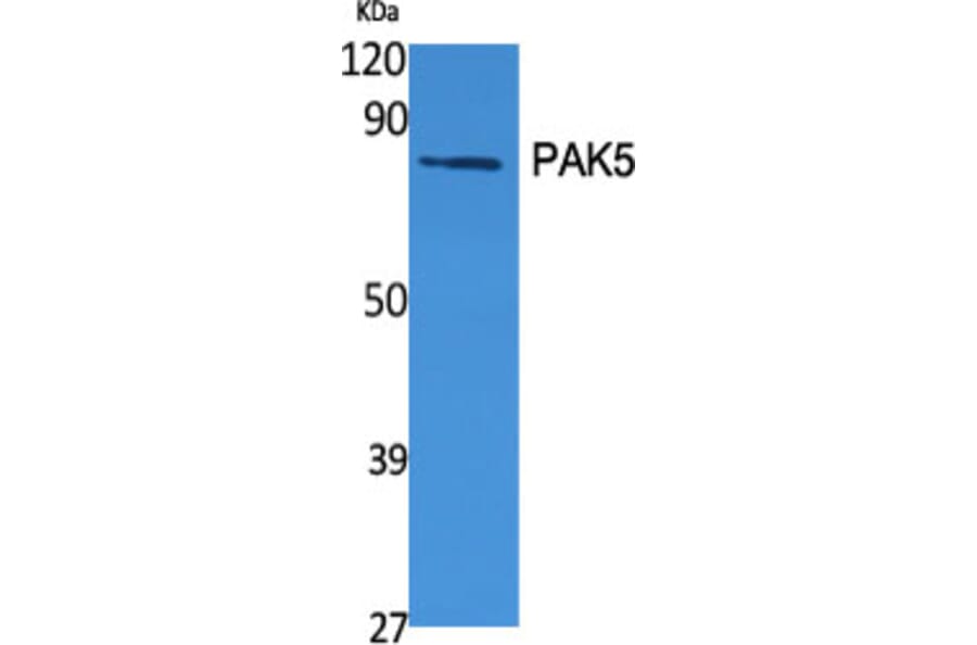 Western Blot - Anti-PAK7 Antibody (C21170) - Antibodies.com