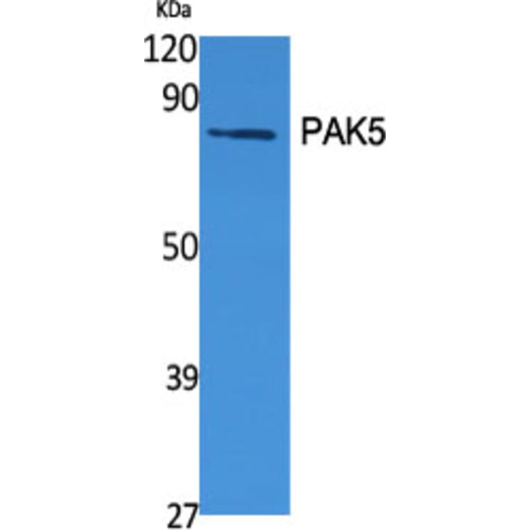 Western Blot - Anti-PAK7 Antibody (C21170) - Antibodies.com