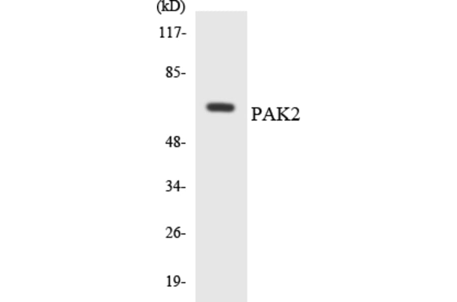Western Blot - Anti-PAK2 Antibody (R12-3298) - Antibodies.com