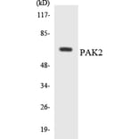 Western Blot - Anti-PAK2 Antibody (R12-3298) - Antibodies.com