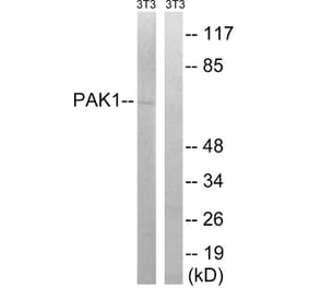 Western Blot - Anti-PAK1 Antibody (B8158) - Antibodies.com